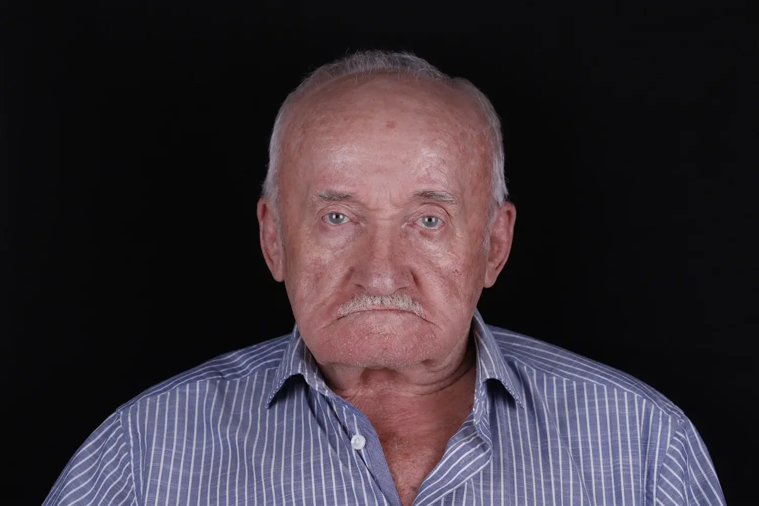 Пациент до и после лечения - случай 10