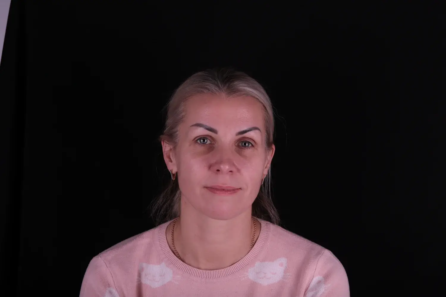 Пациент до и после лечения - случай 11