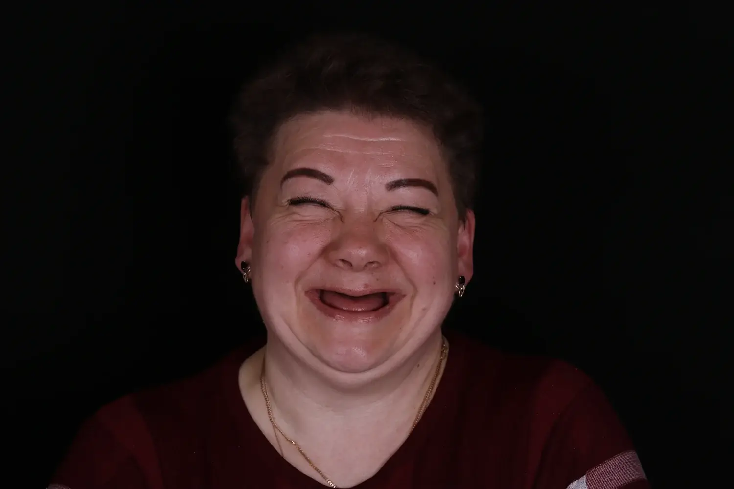 Пациент до и после лечения - случай 12