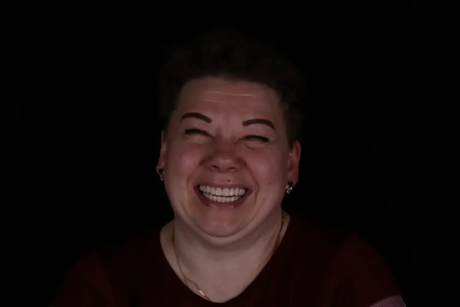 Пациент до и после лечения - случай 12