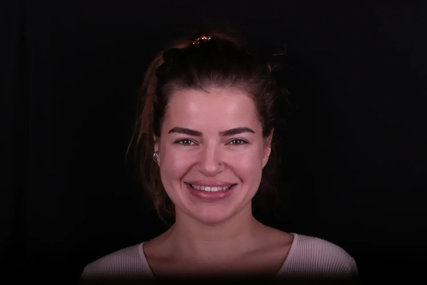 Пациент до и после лечения - случай 13