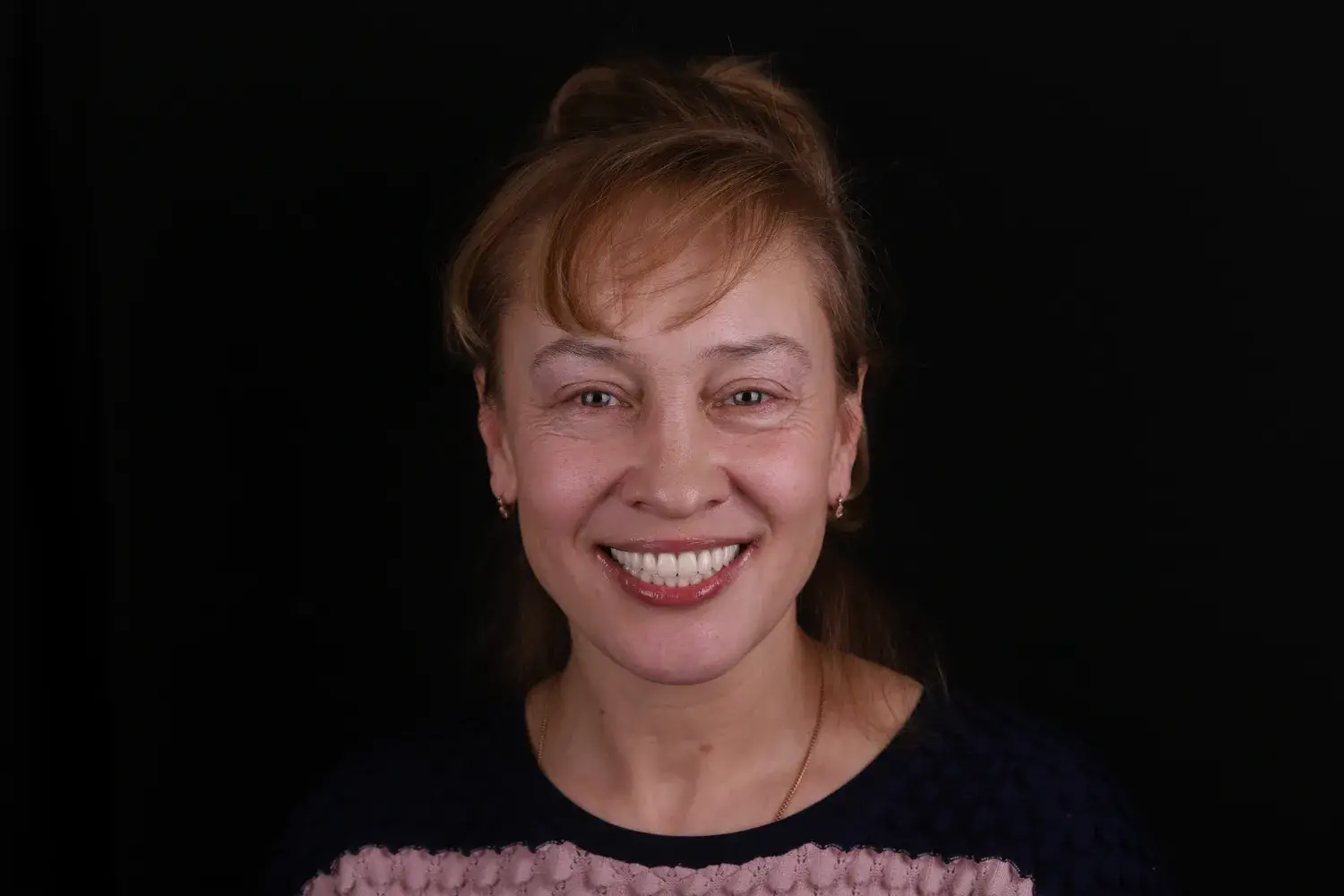 Пациент до и после лечения - случай 2