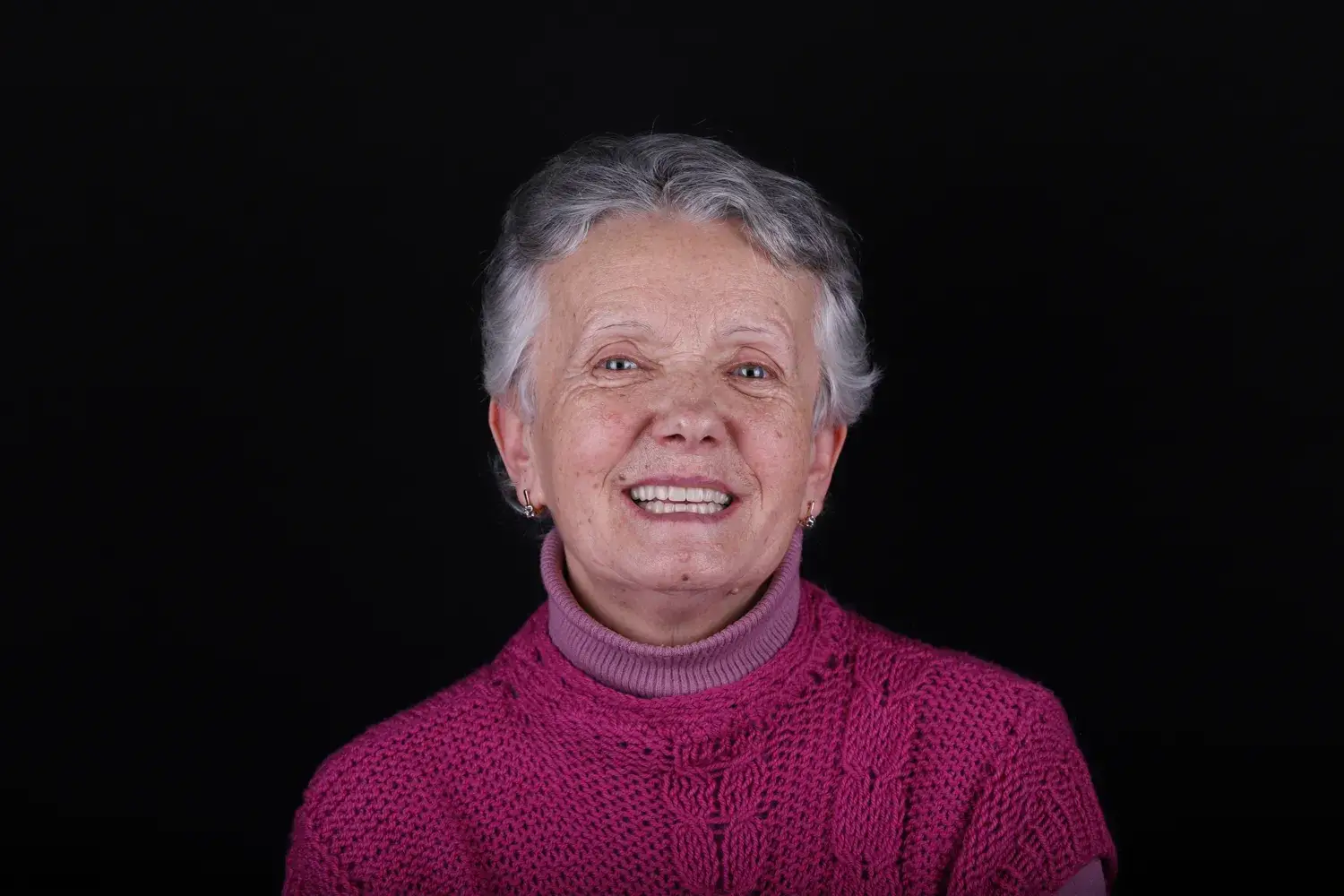 Пациент до и после лечения - случай 6