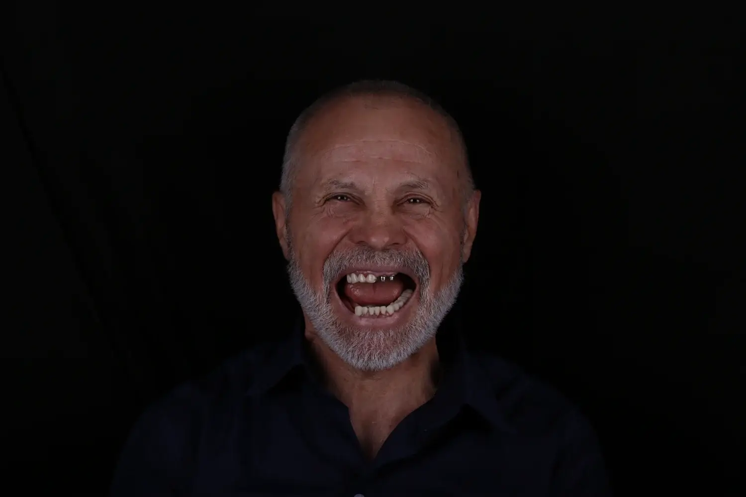 Пациент до и после лечения - случай 9